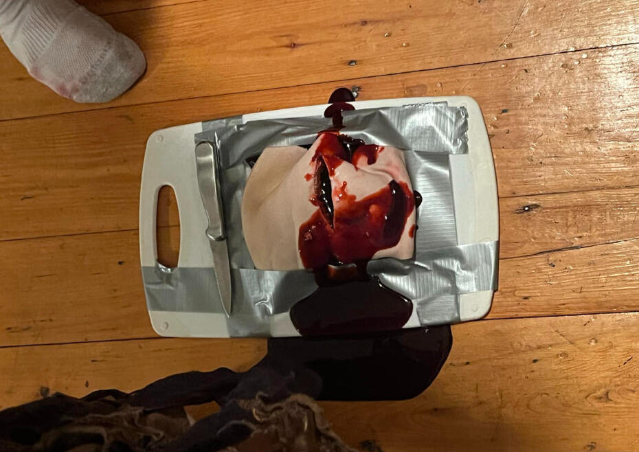 skin lesion sfx